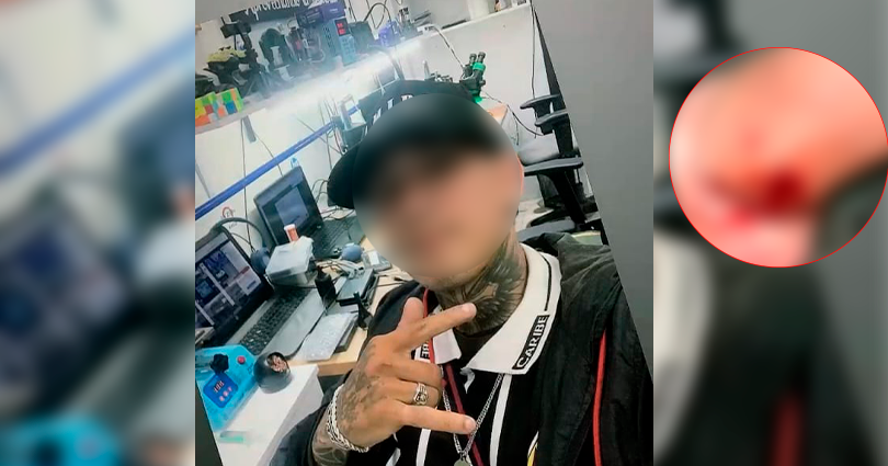 ¡Atención! Joven fue herido de bala en un intento de robo en Ibagué El Irreverente Noticias de Ibague y Tolima, Colombia